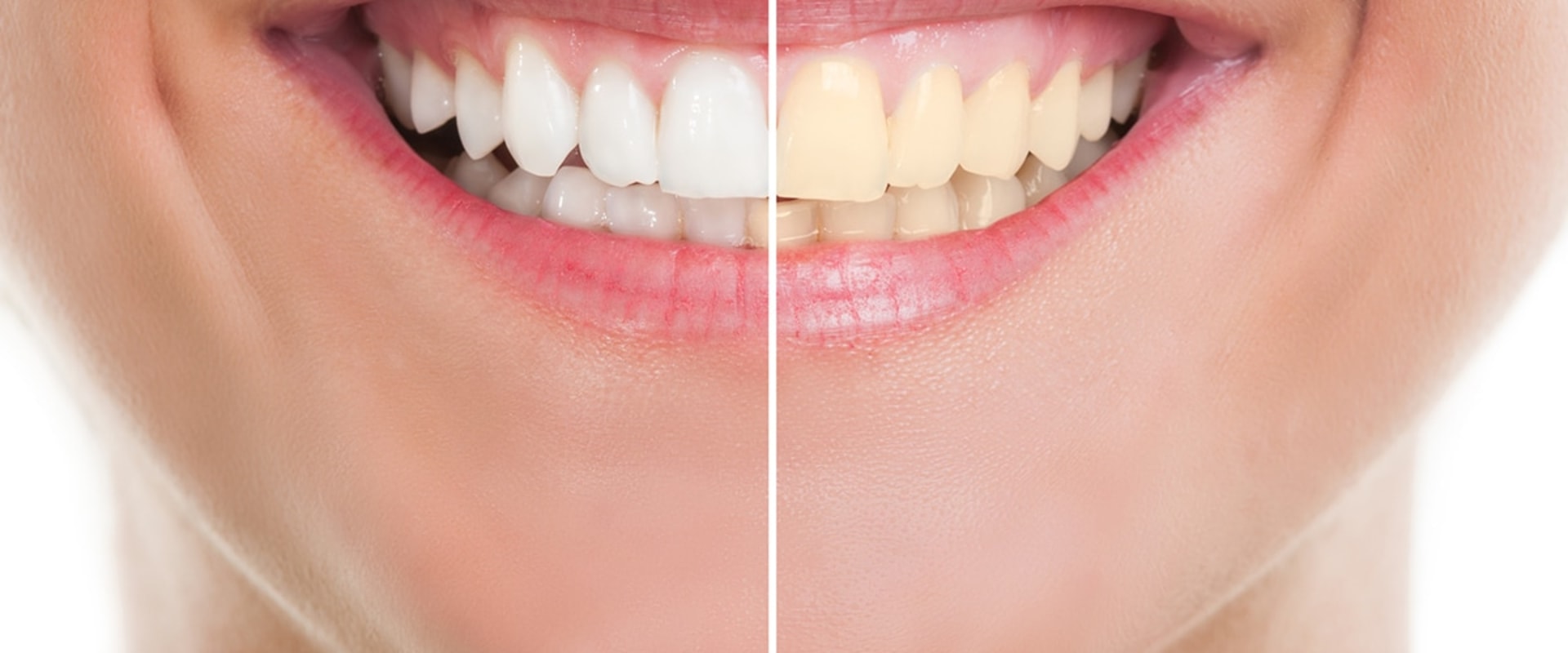 The Benefits of Cosmetic Dentistry A Comprehensive Guide