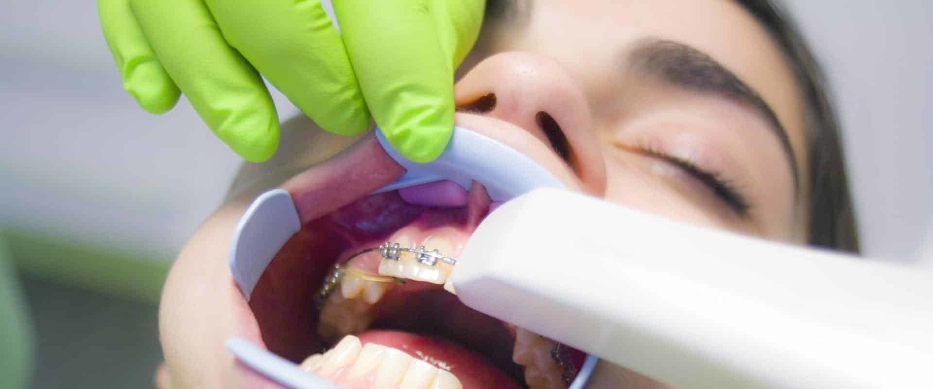 What is Cosmetic Dentistry Grants and How Can It Help You Achieve Your