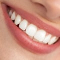 What is Aesthetic Dentistry?