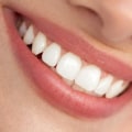 What esthetic dentistry?