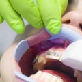 What is cosmetic dentistry grants?