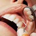 What are cosmetic dental treatments?