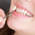 Is cosmetic dentistry painful?