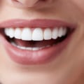 What does cosmetic dentistry cost?