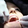 How much is cosmetic dentistry uk?