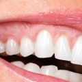 The Benefits of Cosmetic Dentistry