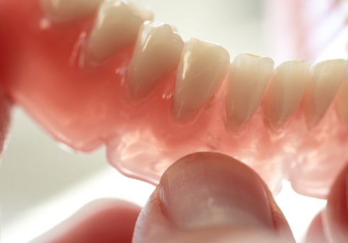What are the four types of dentures?