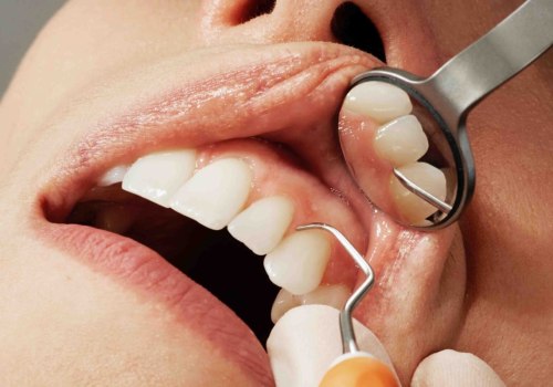What is the Process of Cosmetic Dentistry?