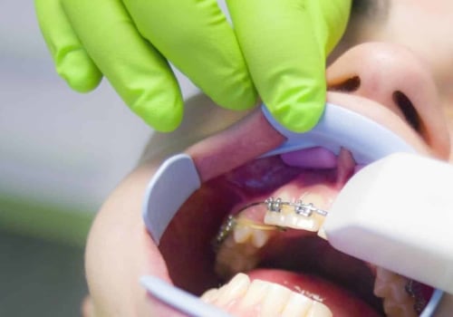 Are Cosmetic Dentistry Grants Legitimate?