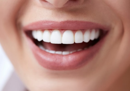 What Does Cosmetic Dentistry Cost? A Comprehensive Guide