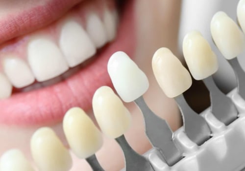 What is the best teeth makeover?