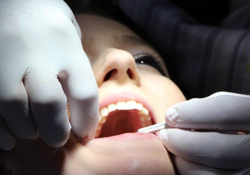 How Much Does Cosmetic Dentistry Cost in the UK?