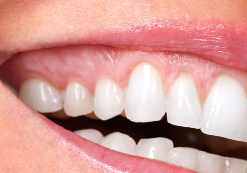 The Benefits of Cosmetic Dentistry