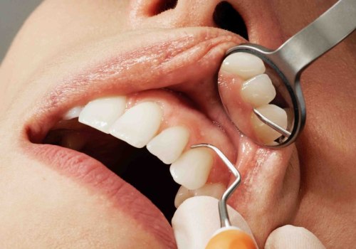 How cosmetic dental work?